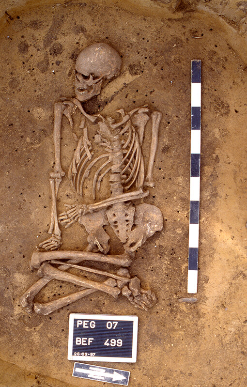 Im dem Skelett eines 35-45 Jahre alten Mannes bei Großstorkwitz (Kr. Leipzig) aus dem 3. Jahrtausend v. Chr. fand sich der Pesterreger Yersinia Pestis.